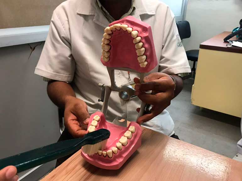 EL 95% DE LAS ATENCIONES  DENTALES SON POR CARIES: IMSS GUERRERO